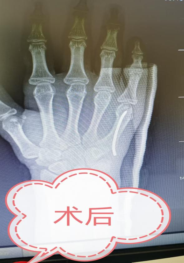 图片43.png