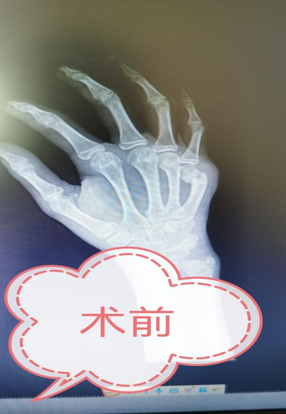 图片42.png